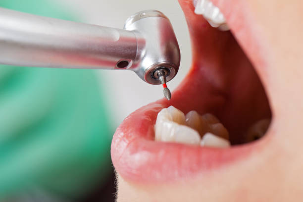 Best Urgent Dental Care for Toothache in Brookville, IN